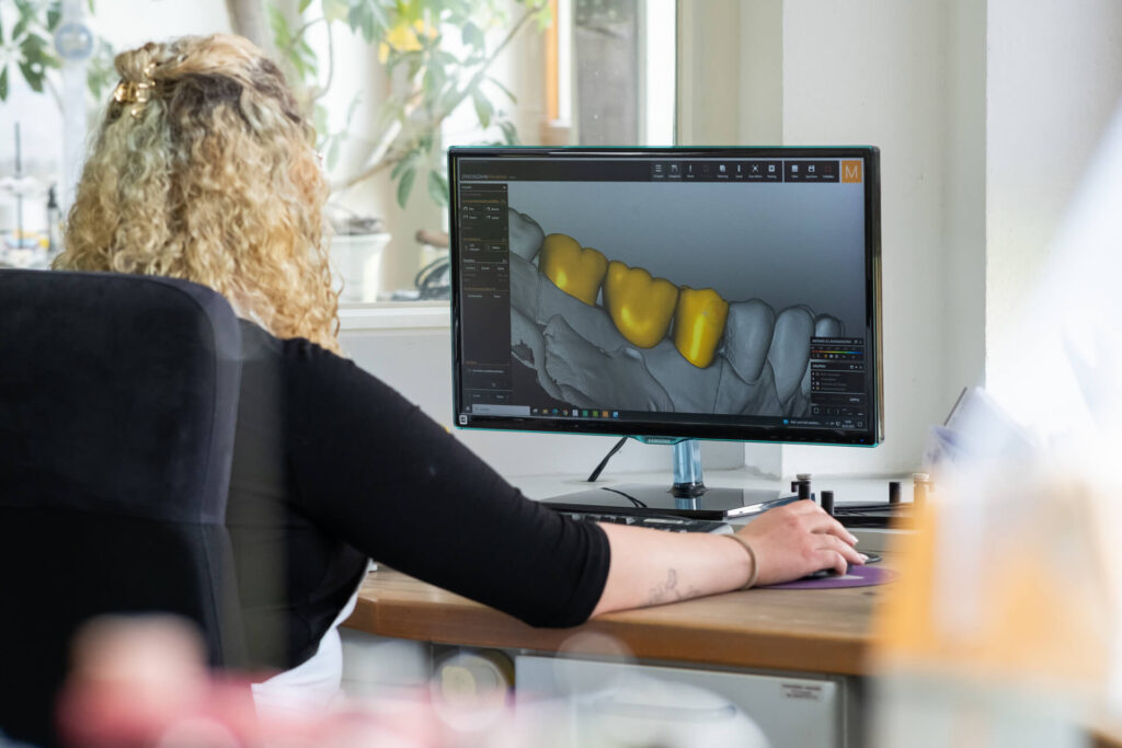 HUB Dental Technik-5674